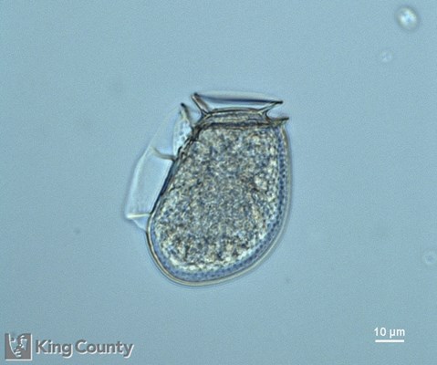 Photo of Dinophysis fortii